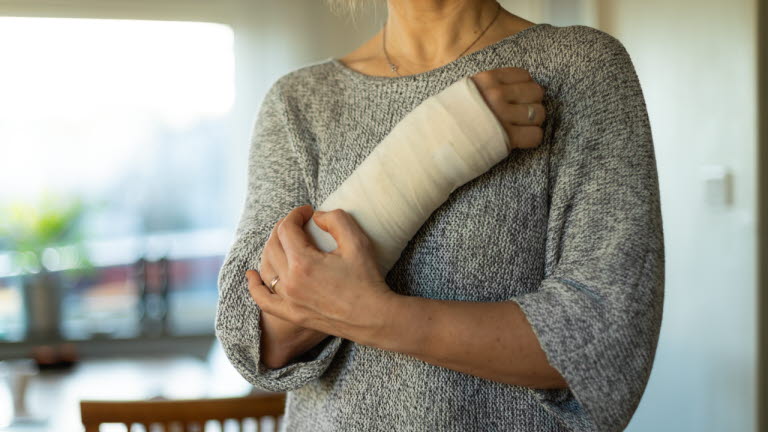 Kvinna med gipsad arm